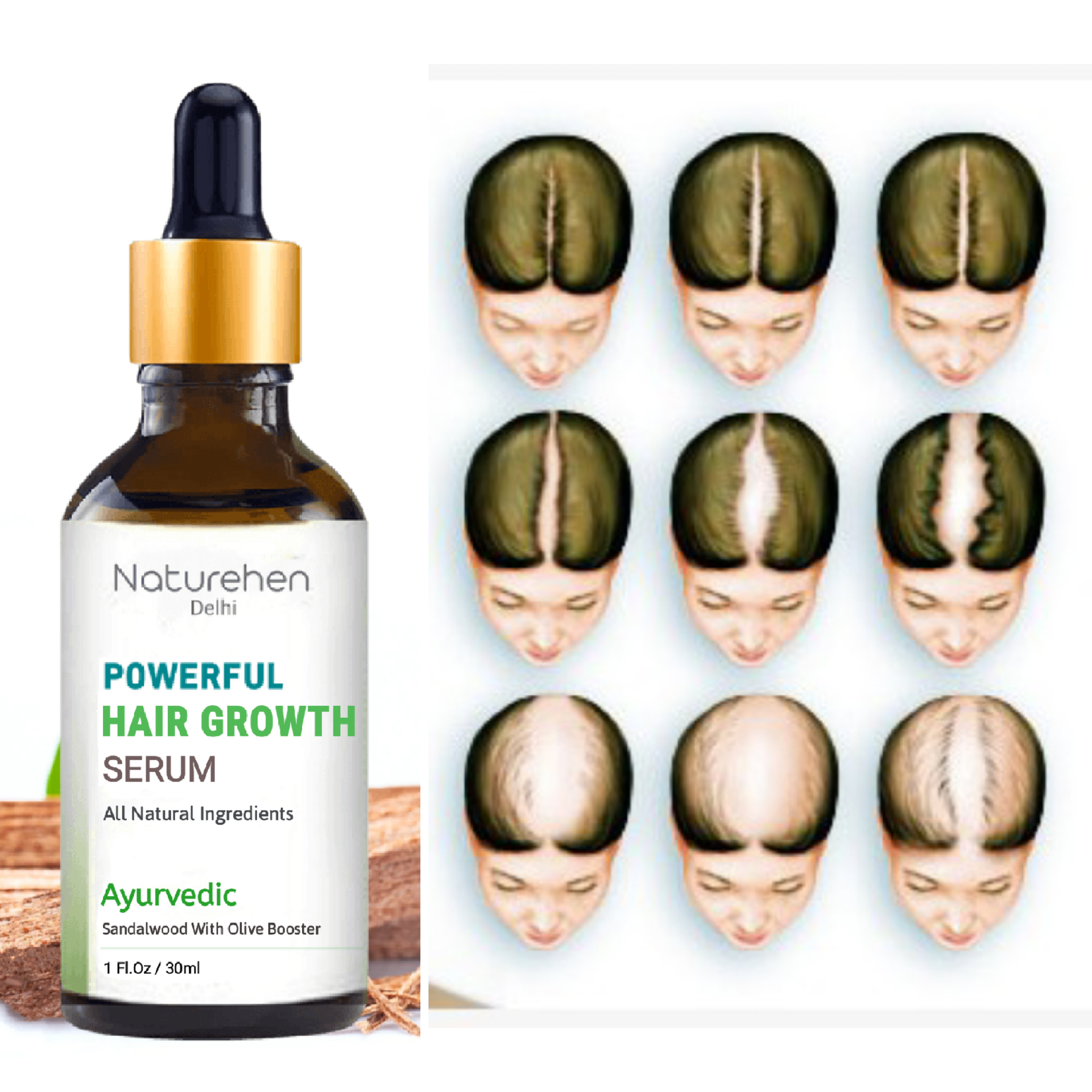 Naturehen Extraordinary Hair oil serum for Men and Women dry rough hair (30 ml)